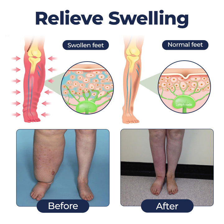 Timilk® SwellRelief Circulation Support Cream.