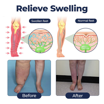 Timilk® SwellRelief Circulation Support Cream.