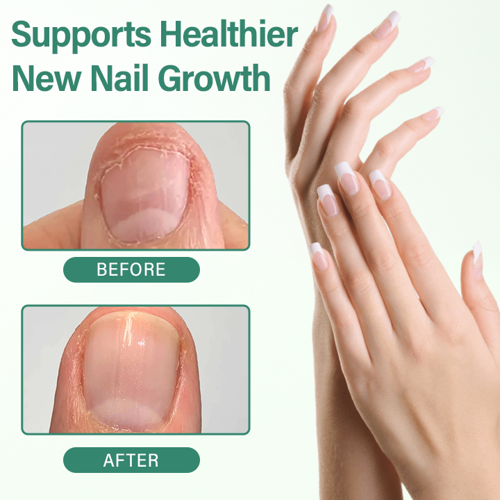 Ceoerty® Nail Detox Penetration Serum Pen