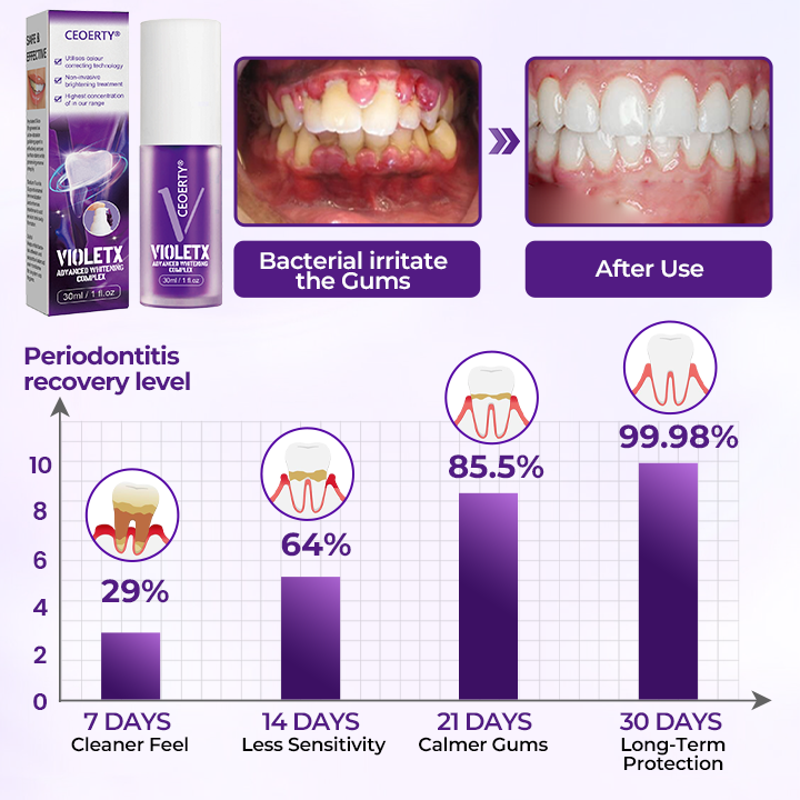 Ceoerty® VioletX Advanced Whitening Complex