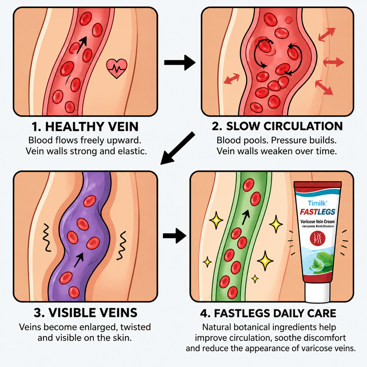 Timilk® FASTLEGS Varicose Vein Cream