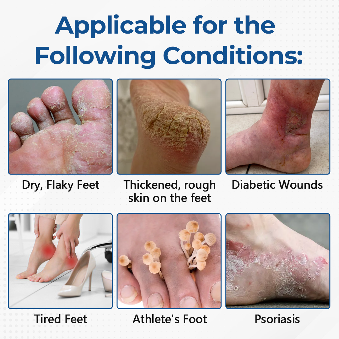 Ceoerty® PureFoot Diabetes Treatment Stick