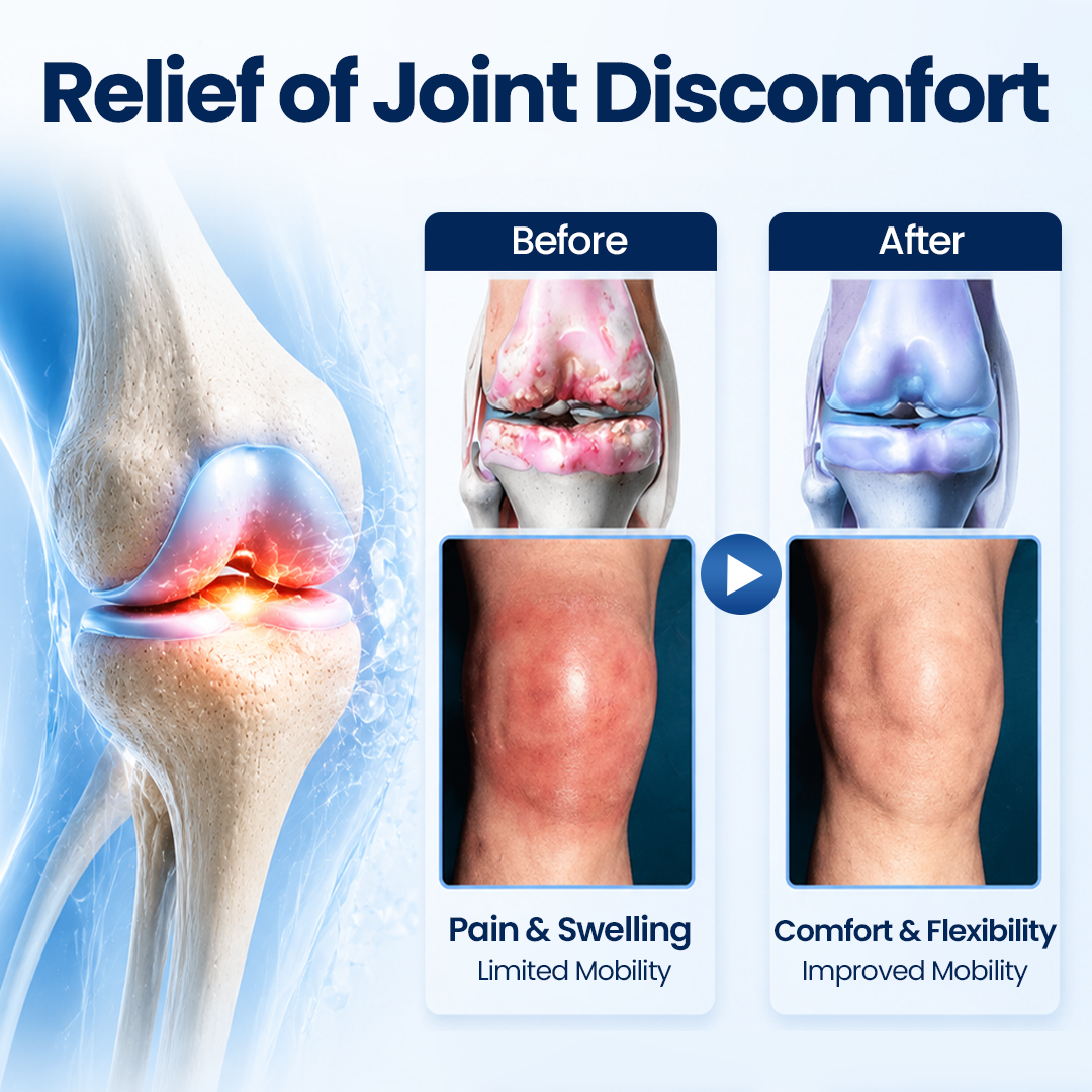 Timilk® ArthriNAD+ Pro Advanced Joint Recovery Cream