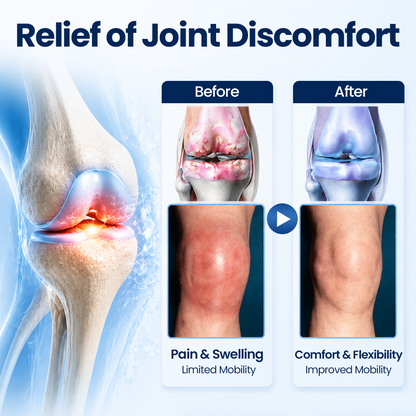 Timilk® ArthriNAD+ Pro Advanced Joint Recovery Cream