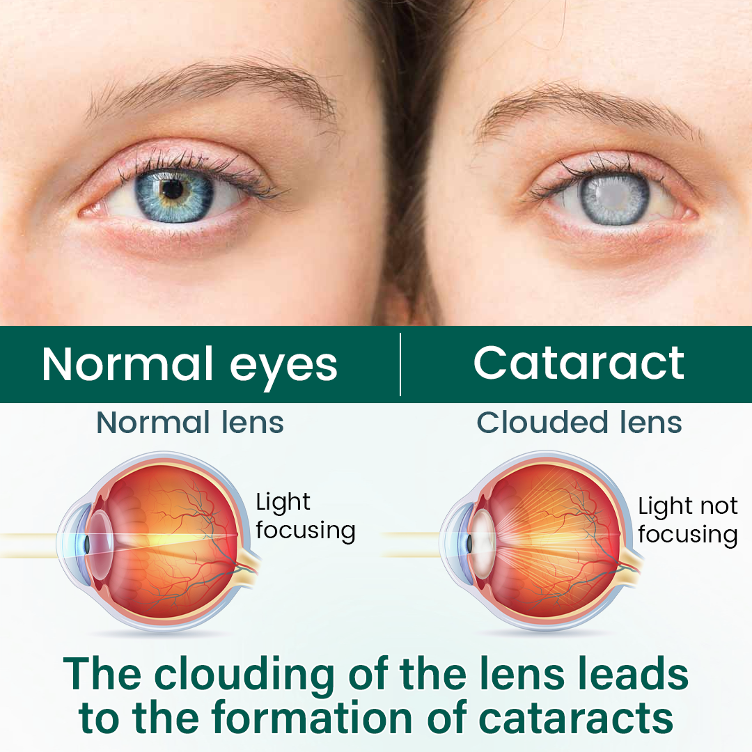Ceoerty® Eye Care Roller Serum