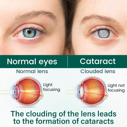 Ceoerty® Eye Care Roller Serum