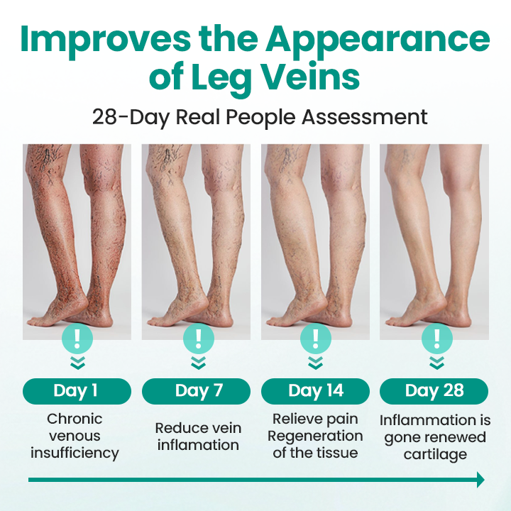 Timilk® LegRenew Varicose Veins Patch.