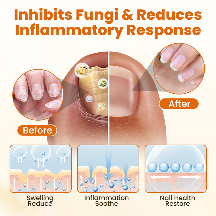 Timilk® FungiBee Advanced Nail Repair Spray