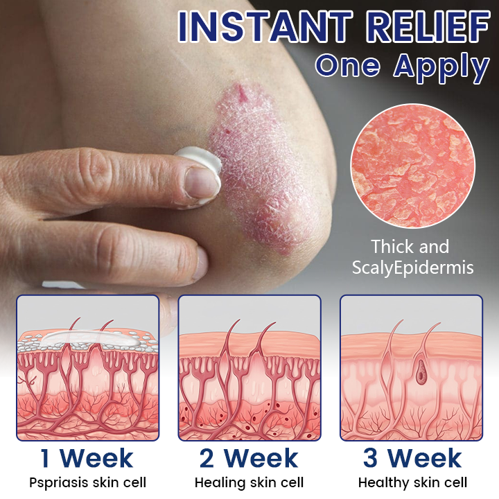Timilk® DermaSooth Repair Cream.