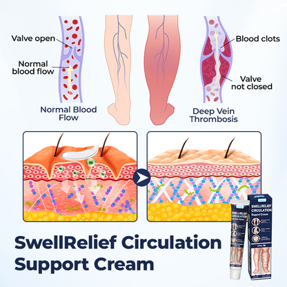 Timilk® SwellRelief Circulation Support Cream.